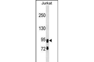 FIG4 Antibody (C-term) (ABIN1537627 and ABIN2849648) western blot analysis in Jurkat cell line lysates (35 μg/lane). (FIG4 Antikörper  (C-Term))