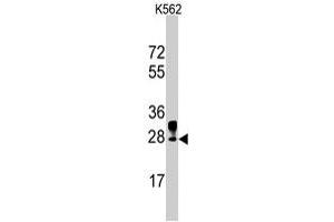 Western blot analysis of ERAS polyclonal antibody  in K-562 cell line lysates (35 ug/lane). (ERAS Antikörper  (N-Term))