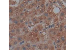 IHC-P analysis of Human Tissue, with DAB staining. (SMPD1 Antikörper  (AA 319-579))