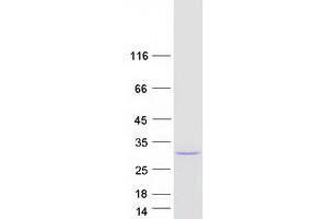 Myosin Light Chain 4, Alkali, Atrial, Embryonic (MYL4) (Transcript Variant 1) protein (Myc-DYKDDDDK Tag)