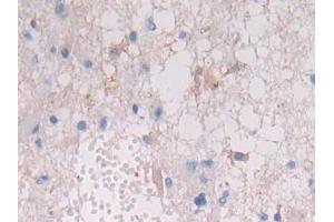 Immunohistochemistry (IHC) image for anti-Major Histocompatibility Complex, Class II, DR beta 1 (HLA-DRB1) (AA 30-266) antibody (ABIN7440764)