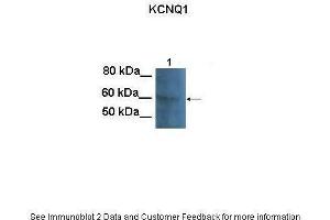 Lanes:   100 ug CHO cell lysate  Primary Antibody Dilution:   1:1000  Secondary Antibody:   Goat anti-rabbit HRP  Secondary Antibody Dilution:   1:25000  Gene Name:   KCNQ1  Submitted by:   Anonymous (KCNQ1 Antikörper  (N-Term))