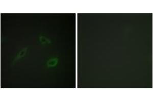 Immunofluorescence analysis of HeLa cells, using CD4 (Ab-433) Antibody. (CD4 Antikörper  (AA 401-450))