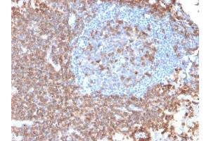 Formalin-fixed, paraffin-embedded human Lymph Node stained with CD43 Mouse Recombinant Monoclonal Antibody (rSPN/839). (Rekombinanter CD43 Antikörper)