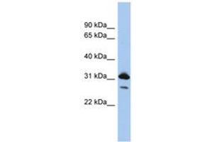 Image no. 1 for anti-RAP1B, Member of RAS Oncogene Family (RAP1B) (N-Term) antibody (ABIN6744003) (RAP1B Antikörper  (N-Term))