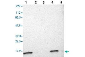 Western blot analysis of Lane 1: RT-4, Lane 2: U-251 MG, Lane 3: Human Plasma, Lane 4: Liver, Lane 5: Tonsil with ATP5D polyclonal antibody . (ATP5F1D Antikörper)