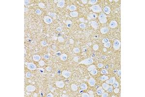 Immunohistochemistry of paraffin-embedded rat brain using SLC1A2 antibody (ABIN5995519) at dilution of 1/100 (40x lens). (SLC1A2 Antikörper)
