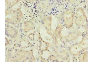 Immunohistochemistry of paraffin-embedded human kidney tissue using ABIN7175029 at dilution of 1:100 (C5ORF22 Antikörper  (AA 101-420))