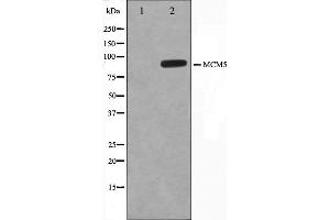 MCM5 Antikörper  (N-Term)