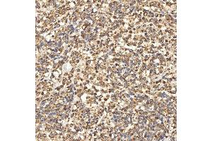 IHC analysis of Citrin/SLC25A13 using anti-Citrin/SLC25A13 antibody (ABIN7599512). (slc25a13 Antikörper  (AA 1-643))