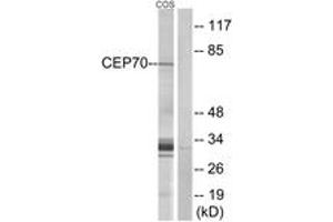 Western blot analysis of extracts from COS cells, using CEP70 Antibody. (CEP70 Antikörper  (AA 241-290))