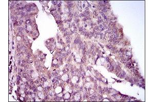Immunohistochemistry (IHC) image for anti-Mitogen-Activated Protein Kinase 14 (MAPK14) (AA 299-360) antibody (ABIN1845584) (MAPK14 Antikörper  (AA 299-360))