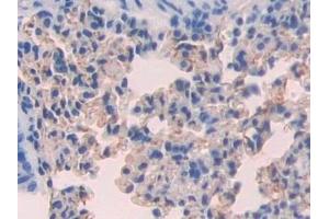Immunohistochemistry (IHC) image for anti-Fucosyltransferase 4 (Alpha (1,3) Fucosyltransferase, Myeloid-Specific) (FUT4) (AA 144-389) antibody (ABIN7440164)