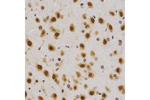 Immunohistochemistry (IHC) image for anti-Histone H4 (2meArg3) antibody (ABIN1872990)