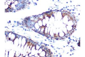 Immunohistochemistry (IHC) image for anti-Folate Receptor 1 (Adult) (FOLR1) (AA 25-93) antibody (ABIN7267224)