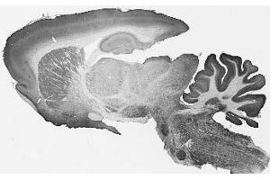Adult rat brain immunohistochemistry. (TMEM91 Antikörper  (Cytosolic, N-Term))