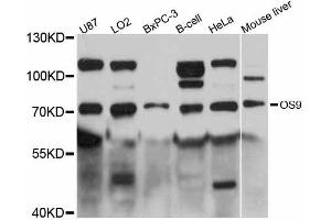 Western blot analysis of extracts of various cell lines, using OS9 antibody (ABIN6292774) at 1:3000 dilution. (OS9 Antikörper)