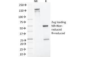 SDS-PAGE Analysis Purified MLH1 Mouse Monoclonal Antibody (MLH1/1324). (MLH1 Antikörper)