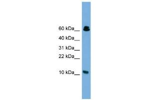 WB Suggested Anti-SUPT4H1 Antibody Titration: 0. (SUPT4H Antikörper  (Middle Region))
