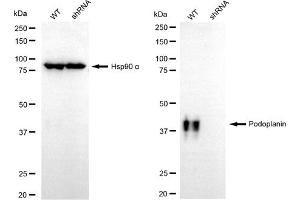 Western blotting analysis using podoplanin antibody (ABIN7799860). (Rekombinanter Podoplanin Antikörper)
