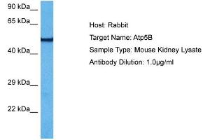 Host:  Mouse  Target Name:  ATP5B  Sample Tissue:  Mouse Kidney  Antibody Dilution:  1ug/ml (ATP5B Antikörper  (N-Term))