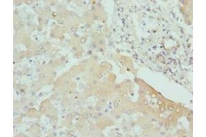 Immunohistochemistry of paraffin-embedded human liver tissue using ABIN7146779 at dilution of 1:100 (CPN1 Antikörper  (AA 209-458))