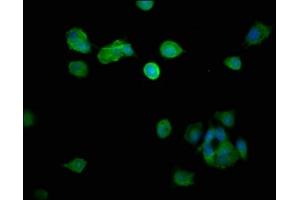 Immunofluorescence staining of MCF-7 cells with ABIN7150805 at 1:266, counter-stained with DAPI. (Dynamitin Antikörper  (AA 1-252))