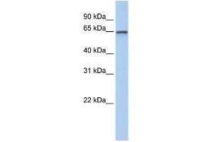 WB Suggested Anti-AHCYL1 Antibody Titration: 0. (AHCYL1 Antikörper  (N-Term))