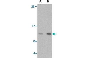 Western blot analysis of HRK in mouse pancreas tissue lysate with HRK polyclonal antibody  at (A) 2. (HRK Antikörper  (Internal Region))