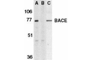 Western blot analysis of BACE in human brain tissue lysate in the absence (A) or presence (B) of blocking peptide and in mouse 3T3 cell lysate (C) with AP30111PU-N BACE antibody at 1 μg/ml. (BACE1 Antikörper  (C-Term))
