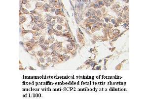 Image no. 1 for anti-Sterol Carrier Protein 2 (SCP2) antibody (ABIN791185) (SCP2 Antikörper)