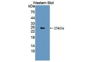 Western Blotting (WB) image for anti-Glial Fibrillary Acidic Protein (GFAP) (AA 256-357) antibody (ABIN1172137) (GFAP Antikörper  (AA 256-357))