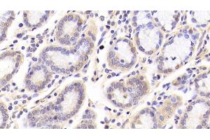 Detection of SIRT3 in Human Stomach Tissue using Polyclonal Antibody to Sirtuin 3 (SIRT3)