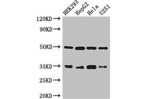 Western Blotting (WB) image for anti-Leucine Zipper Transcription Factor-Like 1 (LZTFL1) (AA 116-299) antibody (ABIN7158030)