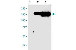 Western blot analysis of CFP monoclonal antibody, clone 98s55  in 10 ug lysate from GFP fusion protein prositive 293 cells. (CFP Antikörper  (N-Term))