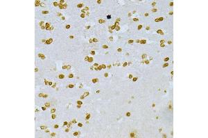 Immunohistochemistry of paraffin-embedded mouse brain using DKC1 Antibody (ABIN5970956) at dilution of 1/200 (40x lens). (DKC1 Antikörper)