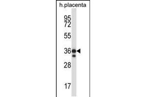 Western blot analysis in human placenta tissue lysates (35ug/lane). (STK26/MST4 Antikörper  (AA 271-299))