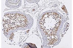 Immunohistochemical staining with TRIM29 polyclonal antibody  in normal testis tissue at 1 : 100 dilution. (TRIM29 Antikörper  (AA 569-583))