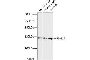 Western blot analysis of extracts of various cell lines, using RBM26 antibody (ABIN6130214, ABIN6146770, ABIN6146772 and ABIN6216994) at 1:3000 dilution. (RBM26 Antikörper  (AA 65-140))
