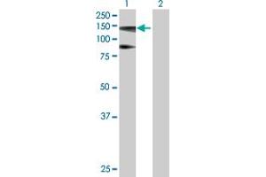 Western Blot analysis of HIP1R expression in transfected 293T cell line by HIP1R MaxPab polyclonal antibody. (HIP1R Antikörper  (AA 1-1068))