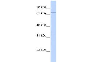 WB Suggested Anti-RNF6 Antibody Titration:  0. (RNF6 Antikörper  (C-Term))