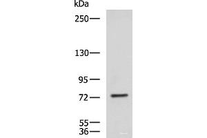 Western blot analysis of NIH/3T3 cell lysate using KIF2A Polyclonal Antibody at dilution of 1:850 (KIF2A Antikörper)