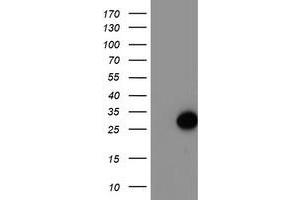 HEK293T cells were transfected with the pCMV6-ENTRY control (Left lane) or pCMV6-ENTRY ARL11 (Right lane) cDNA for 48 hrs and lysed. (ARL11 Antikörper)