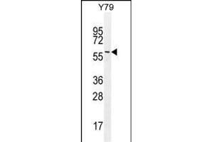 LENG9 Antibody (N-term) (ABIN655202 and ABIN2844817) western blot analysis in Y79 cell line lysates (35 μg/lane).