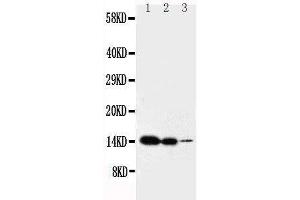 Anti-IL2 antibody, Western blotting Lane 1: Recombinant Mouse IL2 Protein 10ng Lane 2: Recombinant Mouse IL2 Protein 5ng Lane 3: Recombinant Mouse IL2 Protein 2.