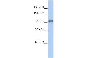 WB Suggested Anti-CCDC52 Antibody Titration: 0. (SPICE1 Antikörper  (N-Term))