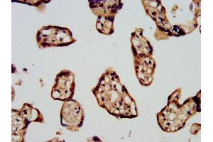 IHC image of ABIN7169072 diluted at 1:500 and staining in paraffin-embedded human placenta tissue performed on a Leica BondTM system. (CDC42BPB Antikörper  (AA 1609-1711))
