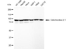 Western blotting analysis using Galactosidase beta 1 antibody (ABIN7798684). (Rekombinanter GLB1 Antikörper)