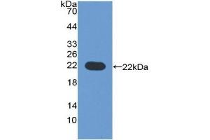 Detection of Recombinant CYP3A4, Human using Polyclonal Antibody to Cytochrome P450 3A4 (CYP3A4) (CYP3A4 Antikörper  (AA 344-497))