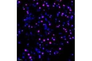 Immunofluorescence of paraffin embedded mouse pancreas using FUS (ABIN7075919) at dilution of 1:1000 (400x lens) (TLS/FUS Antikörper)